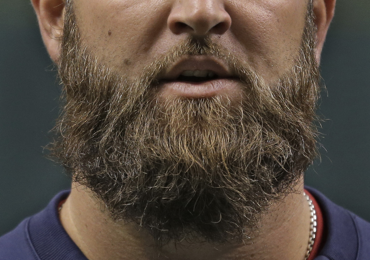 World Series Update: Obstructions, Beards, and the Big Papi